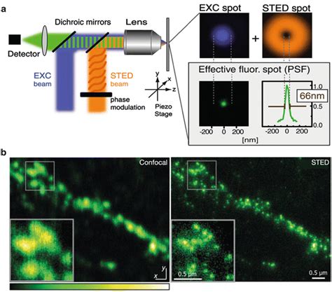 Application of STED Microscopy to Cell Biology Questions | Basicmedical Key