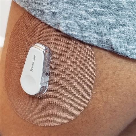 Dexcom G6 Adhesive Patches | Skin Grip