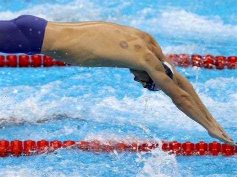 Cupping Therapy Taken By RIO Olympic Athletes - Phelps & Naddour | Best ...