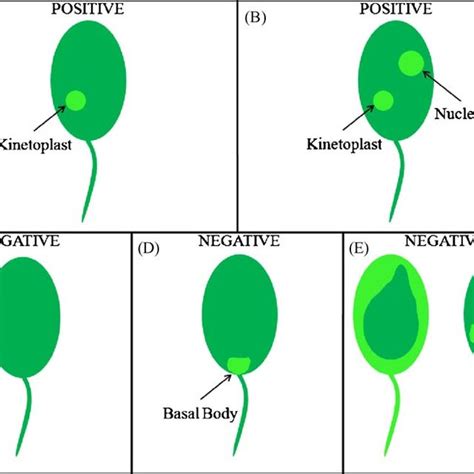 Positive and negative cases depicted through stylized cells. Light and ...