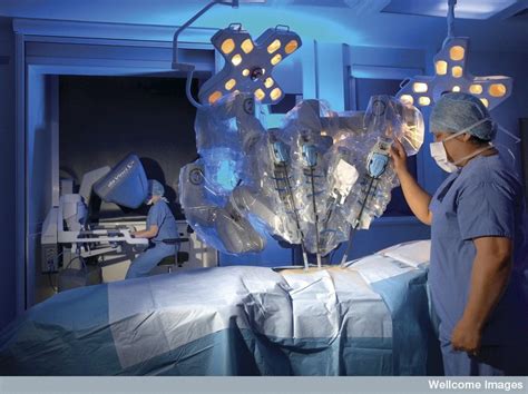 Robot Surgery - the da Vinci Robot - Science Museum Blog