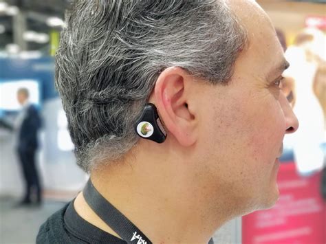 ADHEAR: A Revolutionary Non-Surgical Bone Conduction Hearing Device ...