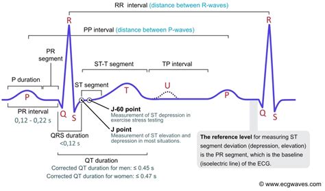 ECG interpretation: Characteristics of the normal ECG (P-wave, QRS ...