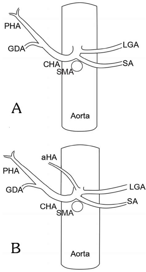 A. Schematic diagram showing the three usual branches: the left gastric ...