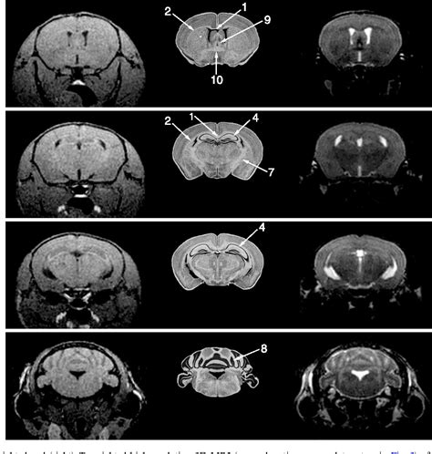 Figure 4 from High-resolution 3D MRI of mouse brain reveals small ...