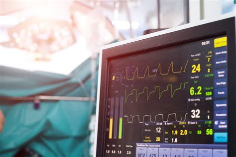 The Mechanisms of Capnography for Anesthesia