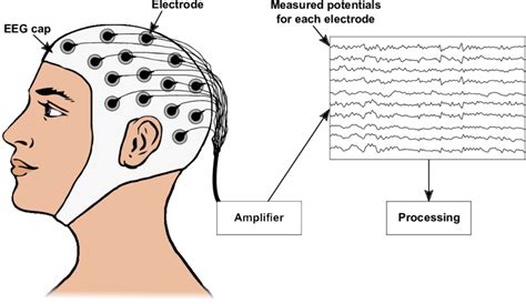 Electroencephalogram Eeg Uses Procedure Results