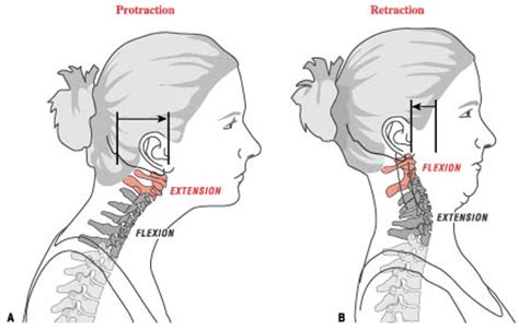 First picture is CAPITAL extension 6x6 #5. (Second picture) is CERVICAL ...