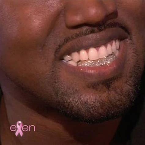 Kanye West replaces his bottom teeth with diamonds | London Evening ...