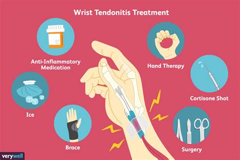 Wrist Tendonitis: Signs, Causes, and Treatments