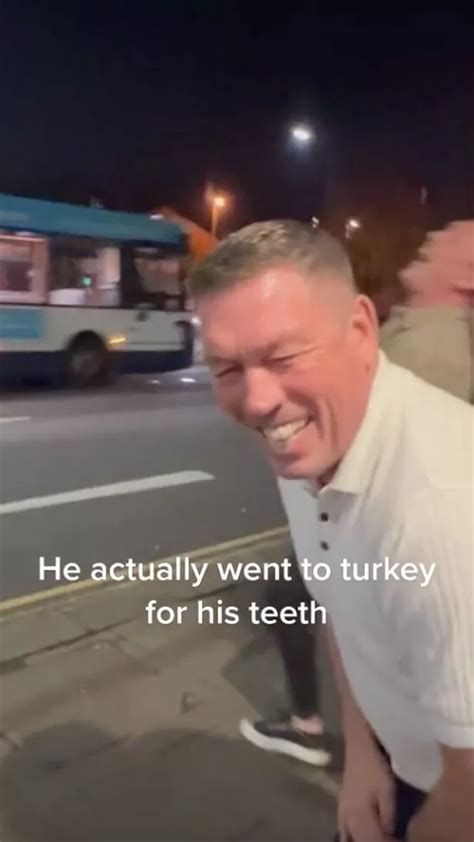 Rugby league star called out for his 'Turkey teeth’ in hilarious visit ...