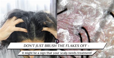 4 signs that you’re suffering from scalp inflammation – and what to do ...