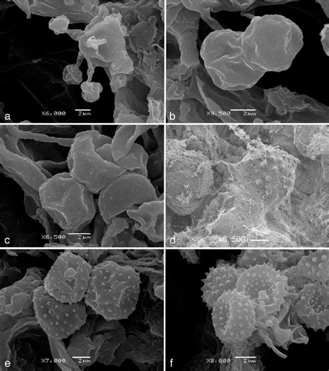 Microscopic structures of Basidiodendron spp. as seen in scanning ...