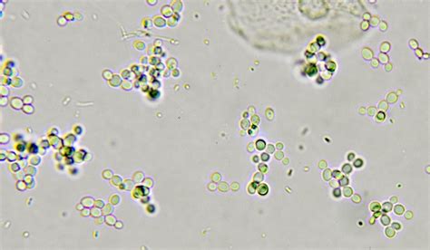 Does Yeast Reproduce by Budding?