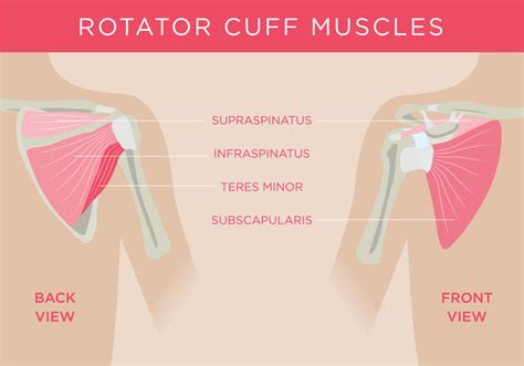 Pros and Cons of Reverse Shoulder Replacement Surgery