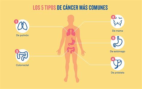 Diferentes Tipos De Cancer