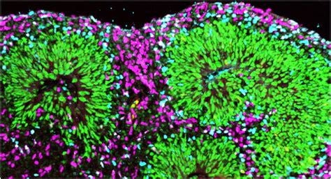 Organoids- Advanced 3D Cell Culture - Kosheeka