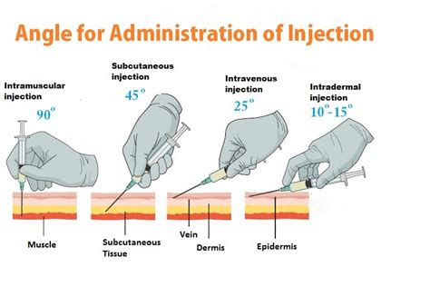 Angles of Administration of Injection - ID, IM, SC, IV