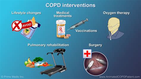 Slide Show - Management and Treatment of COPD