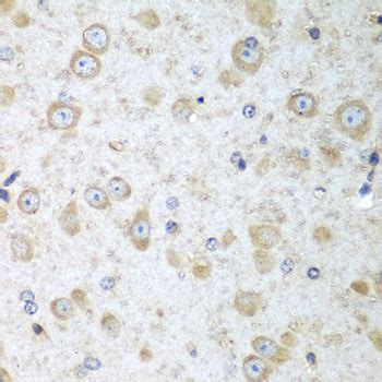 Anti-TRH / Thyrotropin Releasing Hormone Antibody | Rabbit IHC,WB | LSBio