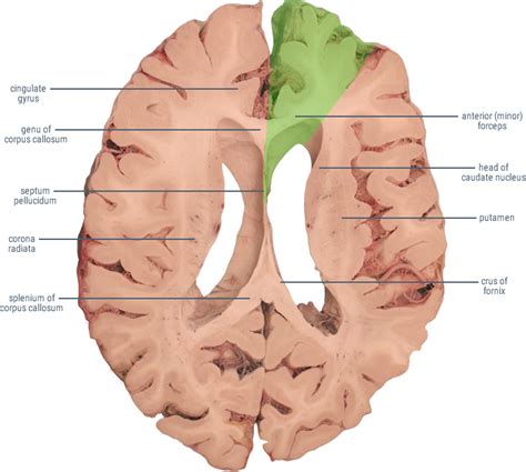 Anterior Cerebral Artery