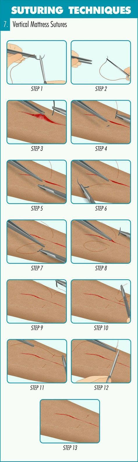 11 Best Suture methods images | Medical, Emergency medicine, Surgical tech