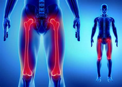 Osteosarcoma: 10 Osteosarcoma Symptoms