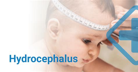 Hydrocephalus. Causes, Symptoms, Diagnosis and Treatment.