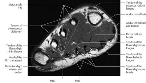 Foot Muscle Anatomy Mri