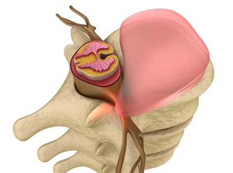 Bone Marrow Cancer Symptoms - Health Hearty