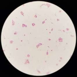 Arrangement of Corynebacterium spp. by Gram's stain showing ...