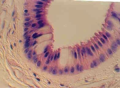 STRATIFIED COLUMNAR OR CUBOIDAL EPITHELIUM | Microanatomy Web Atlas ...