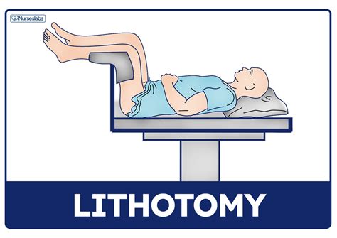 Dorsal Lithotomy Position