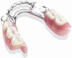 Removable Partial Dentures: Everything You Need to Know