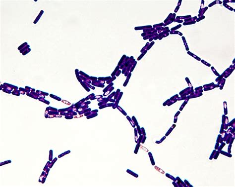 Bacillus Species Gram Stain