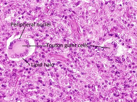 Moran CORE | Cellular Histopathology