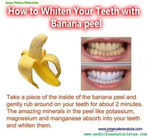 20 Banana Peel Uses | Pioneering The Simple Life