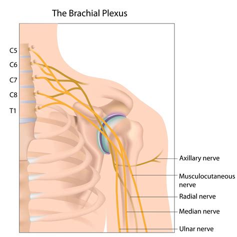 Erb's Palsy | Degrees of Peripheral Nerve Injury | Clinical Negligence Team