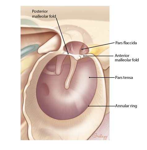 Tympanic Membrane Perforations – Oto Surgery Atlas