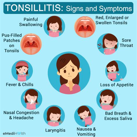 How Is Tonsillitis Diagnosed and Treated? - eMediHealth