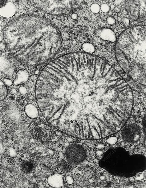 Transmission electron micrograph of mitochondria - Stock Image - G465 ...