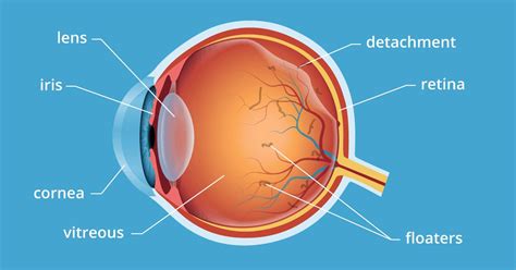 Eye floaters and flashes: When is it an emergency? | All About Vision