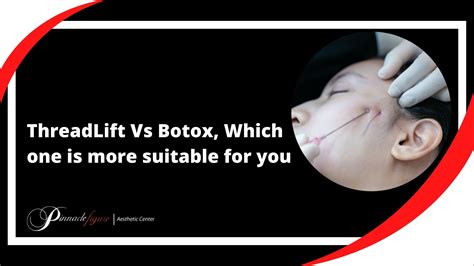 ThreadLift Vs Botox, Which one is more suitable for you?