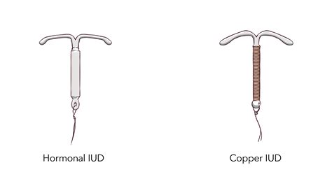 IUD Birth Control | Info About Mirena & Paragard IUDs