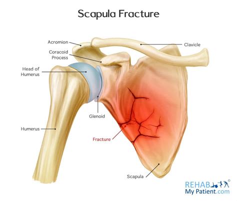 Scapular Anatomy - Anatomical Charts & Posters