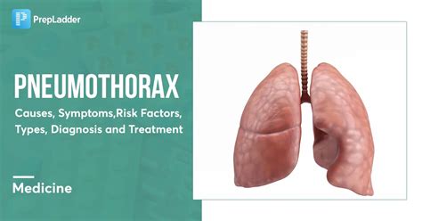 Pneumothorax: Causes, Symptoms, Diagnosis & Treatment