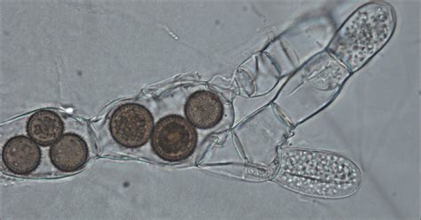 Fungal Cell Under Microscope