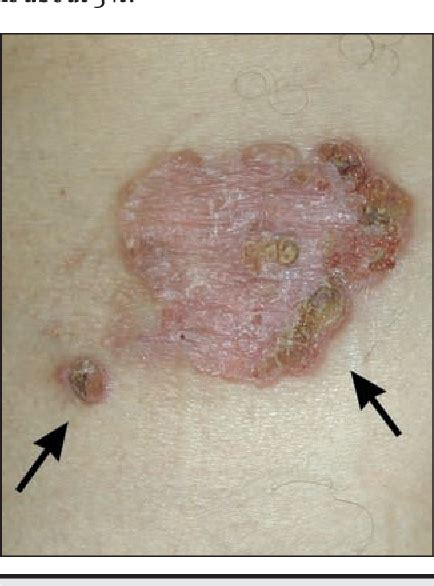 Figure 1 from Gastroenteric duplication cyst | Semantic Scholar