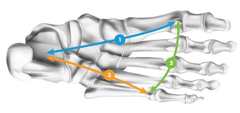 The Three Arches of the Foot | Foot Levelers