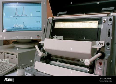 Electrophoresis genetic analysis. Results of the analysis of DNA ...